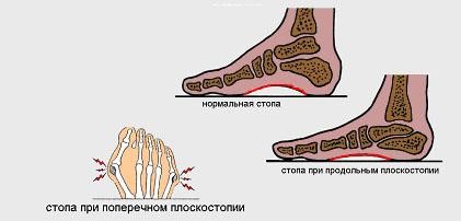 Клиника и диагностика повреждений стопы и нарушений кровообращения
