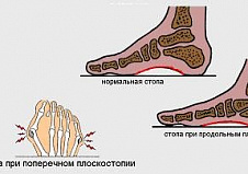 Клиника и диагностика повреждений стопы и нарушений кровообращения