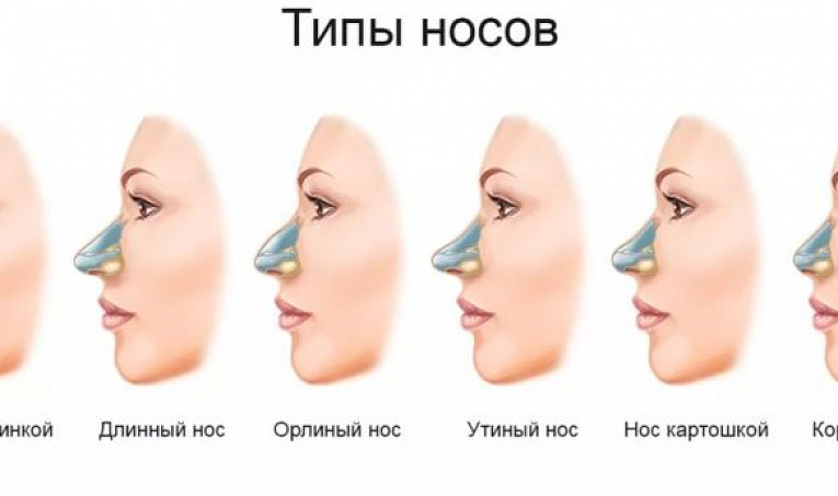 Варианты реконструктивной хирургии дефектов кончика носа