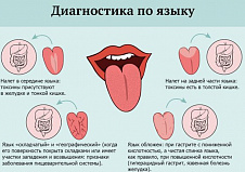 У храпуна язык раздвоился во рту